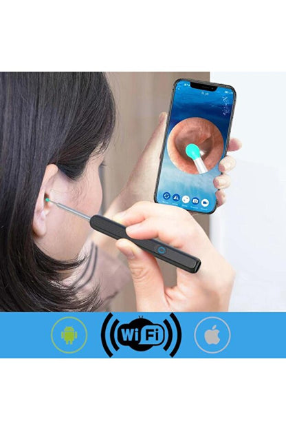 Kablosuz Wifi Kulak Temizleme Kamerası - Ios Android Iphone Uyumlu 1296p Hd Led Otoskop Kam