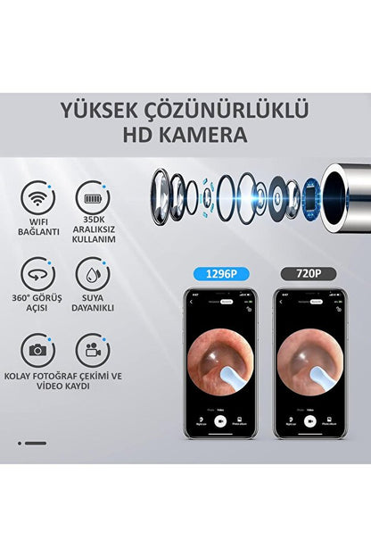 Kablosuz Wifi Kulak Temizleme Kamerası - Ios Android Iphone Uyumlu 1296p Hd Led Otoskop Kam